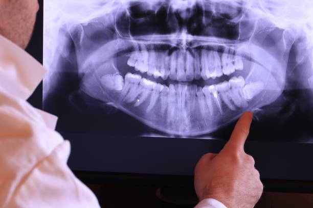 Best Emergency Dentist for Special Needs Patients in Hampton, IA