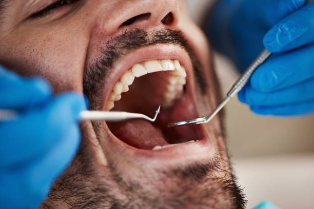 Best Weekend Emergency Dentist in Hampton, IA
